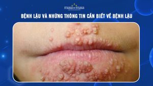 [TỔNG HỢP] Bệnh lậu và những thông tin cần biết về bệnh lậu