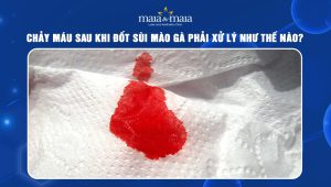 chảy máu sau khi đốt sùi mào gà