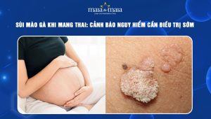 sùi mào gà khi mang thai