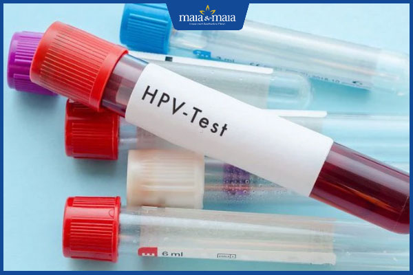 xét nghiệm hpv