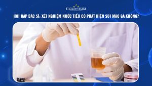 xét nghiệm nước tiểu có phát hiện sùi mào gà không