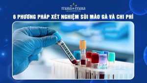 xét nghiệm sùi mào gà