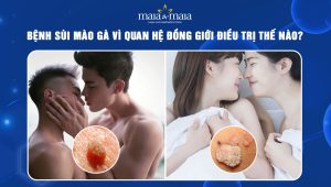 bệnh sùi mào gà vì quan hệ đồng giới