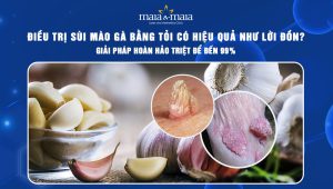 điều trị sùi mào gà bằng tỏi