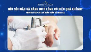 đốt sùi mào gà bằng nito lỏng