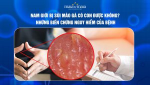 nam giới bị sùi mào gà có con được không