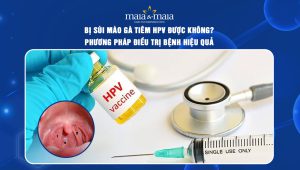 bị sùi mào gà có tiêm hpv được không