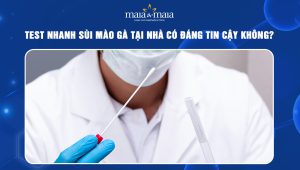 test nhanh sùi mào gà tại nhà