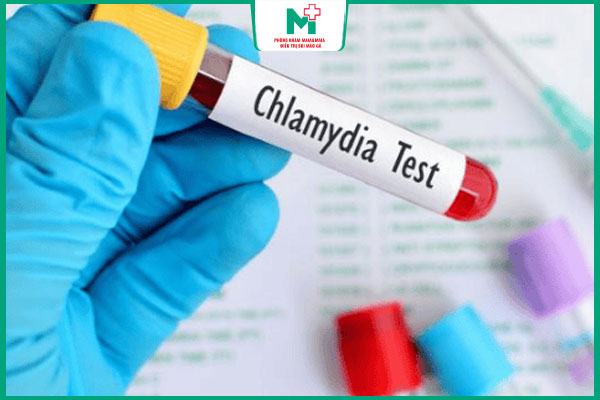 đồng nhiễm chlamydia