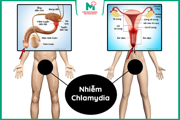bệnh chlamydia là gì