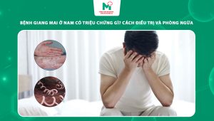 bệnh giang mai ở nam