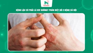 bệnh lậu có phải là HIV không