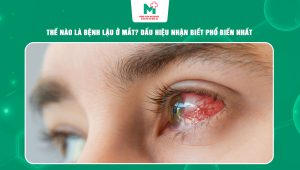 bệnh lậu ở mắt