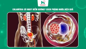 Chlamydia có nguy hiểm không