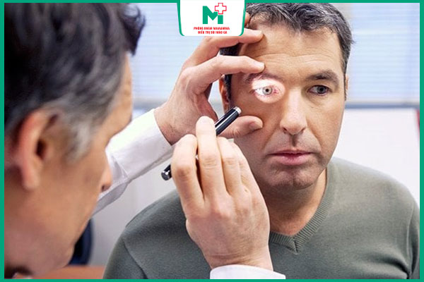 giang mai gây mù loà