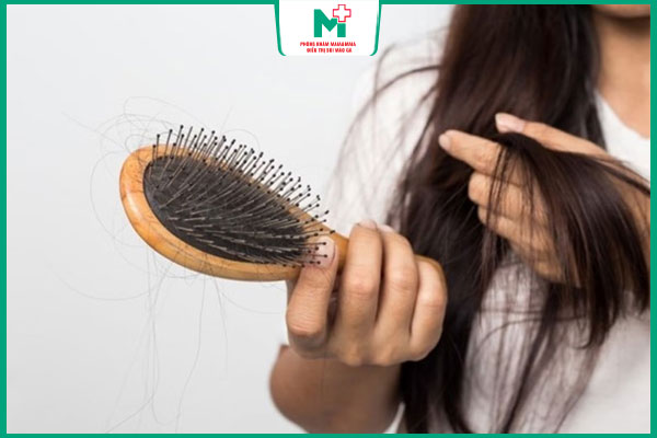rụng tóc do giang mai