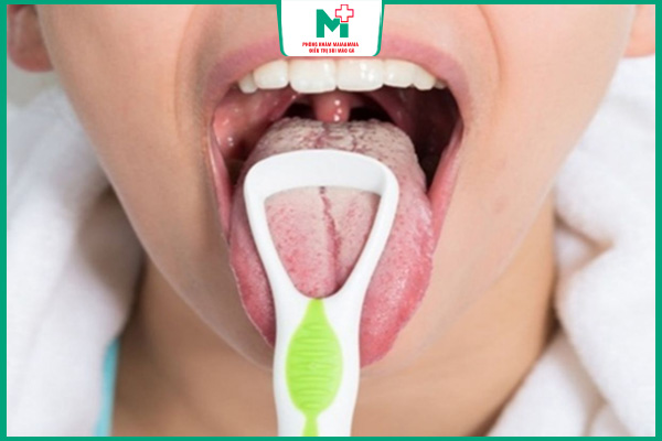triệu chứng chlamydia ở miệng