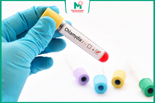 xét nghiệm chlamydia