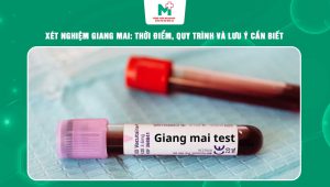 xét nghiệm giang mai