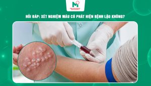 xét nghiệm máu có phát hiện bệnh lậu không