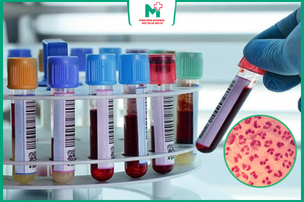 xét nghiệm máu phát hiện bệnh lậu