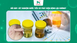 xét nghiệm nước tiểu có phát hiện bệnh lậu không