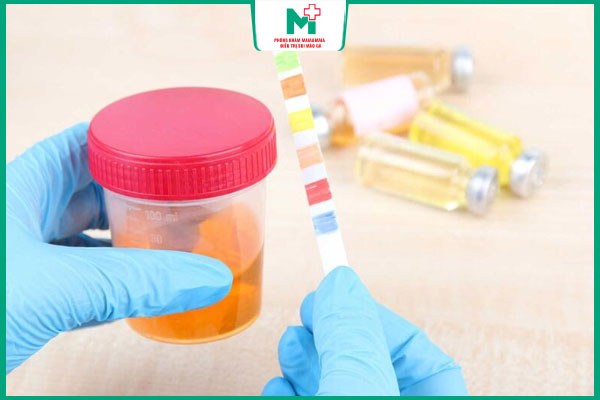 xét nghiệm nước tiểu phát hiện bệnh lậu