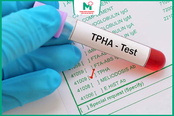 xét nghiệm tìm kháng thể đặc hiệu