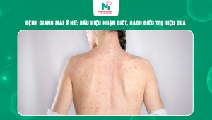 bệnh giang mai ở nữ