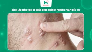 bệnh lậu mãn tính có chữa được không