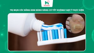 cách trị mụn cóc bằng kem đánh răng