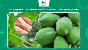 cách trị mụn cóc bằng mủ đu đủ