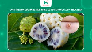 cách trị mụn cóc bằng trái nhàu