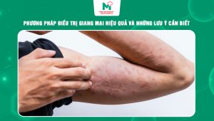 điều trị giang mai