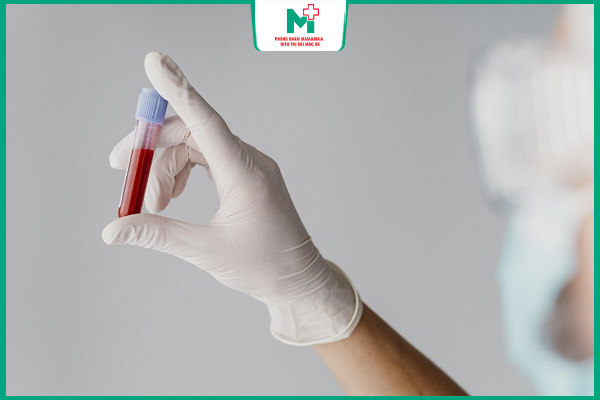 giá xét nghiệm giang mai