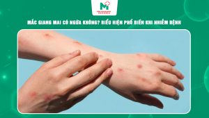 giang mai có ngứa không