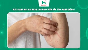 giang mai giai đoạn 2