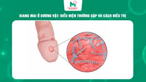 giang mai ở dương vật
