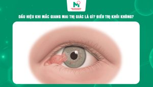 giang mai thị giác