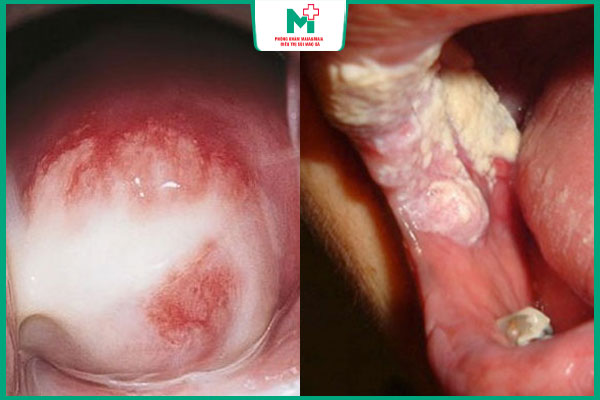 phân biệt hai bệnh xã hội