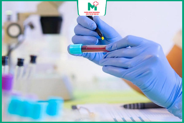 quy trình xét nghiệm rpr