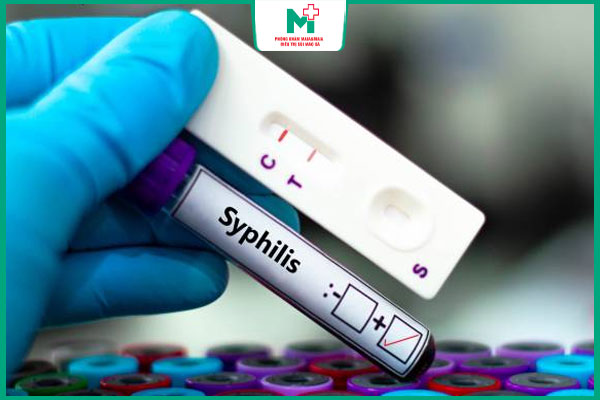 test nhanh giang mai