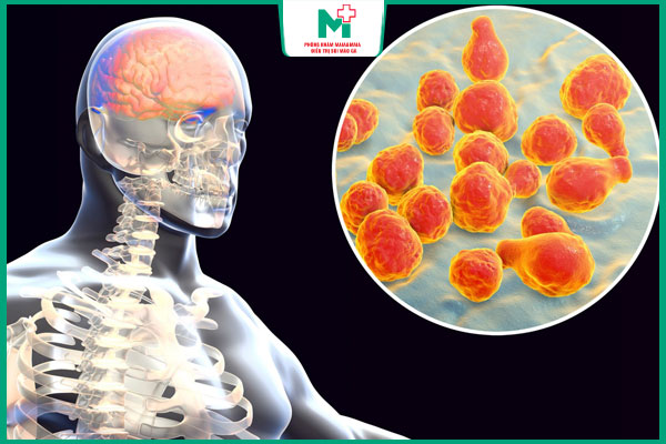 thể giang mai thần kinh