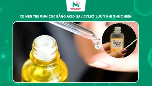 trị mụn cóc bằng acid salicylic
