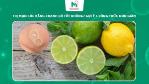trị mụn cóc bằng chanh