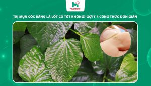 trị mụn cóc bằng lá lốt