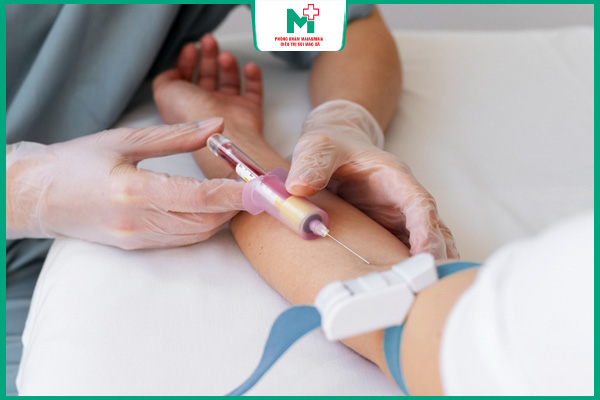 tuân thủ phác đồ điều trị