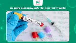 xét nghiệm giang mai bao nhiêu tiền