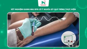 xét nghiệm giang mai rpr