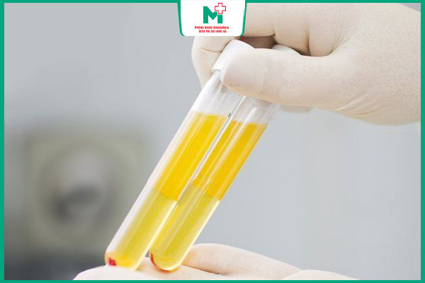 xét nghiệm huyết thanh